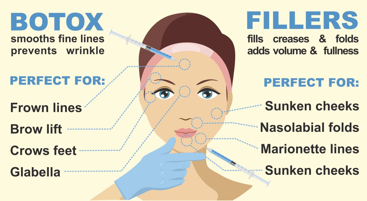 botox fillers